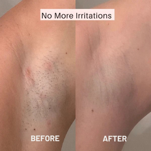 Rasierer für Frauen – Glatte Haut ohne Irritation 